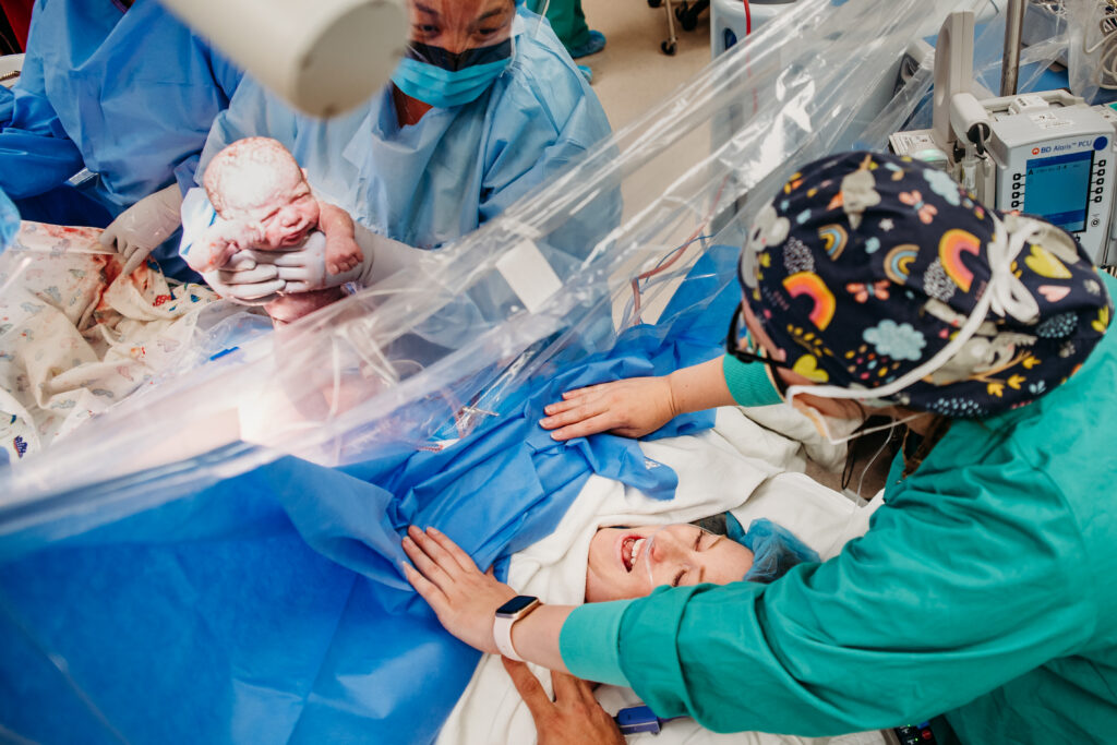 Mom seeing her baby for the first time during a cesarean birth at Avista hospital in Colorado. Cesarean photography.