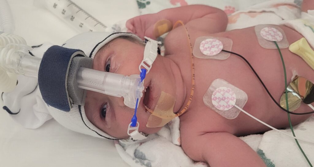 The very first photo of twin B - Born at Avista Hospital in Colorado. CPAP machine on newborn.
