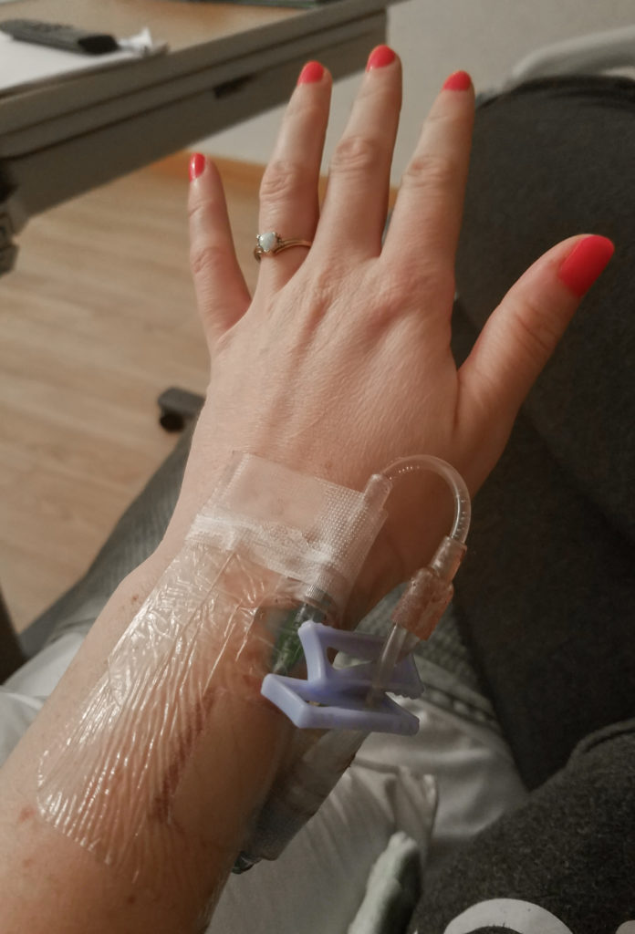 The IV placed on the back of the authors wrist