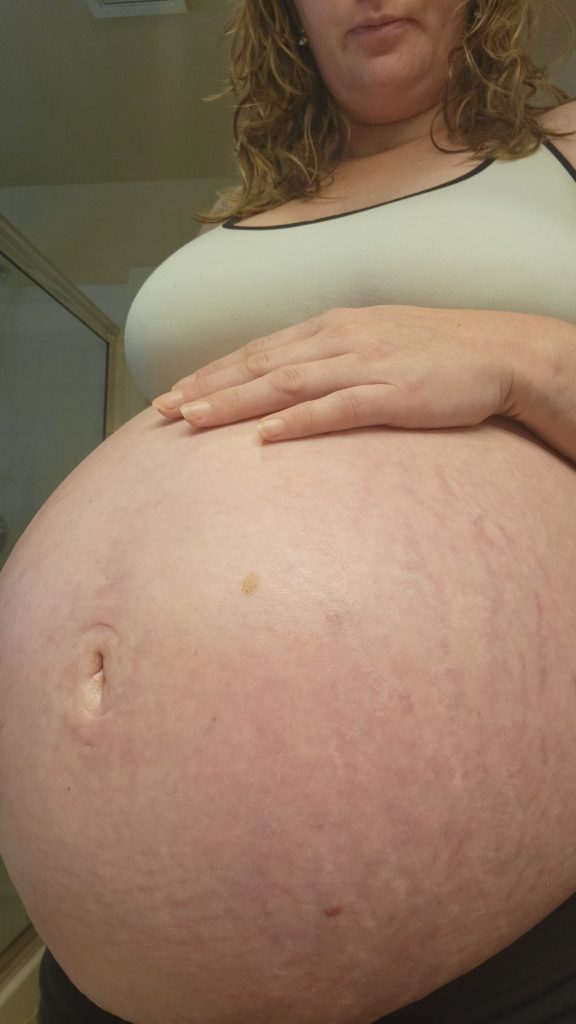Very large pregnant belly twins stretch marks 33 weeks third trimester