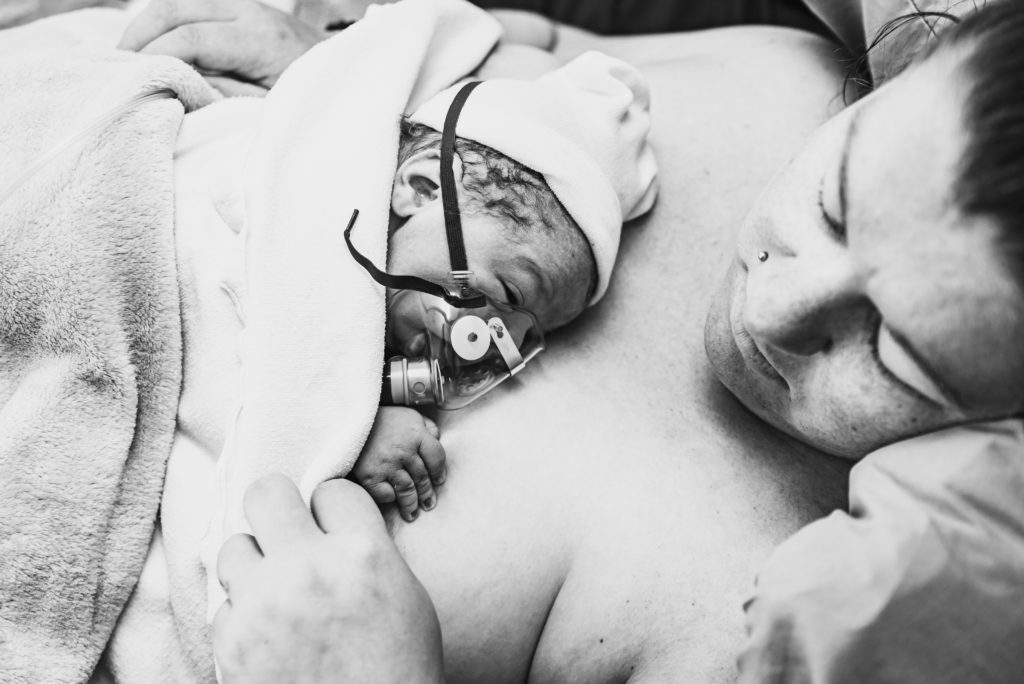 Baby with oxygen mask on moms chest 