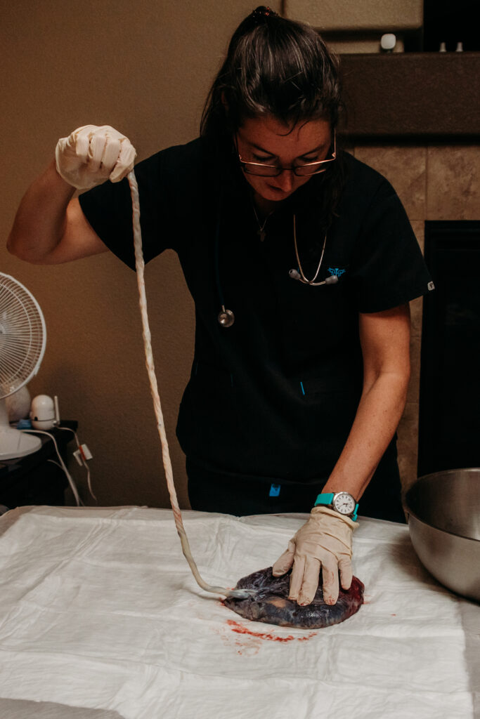 Midwife checking an intact placenta and umbilical cord. Home birth midwife photography Northern Colorado.