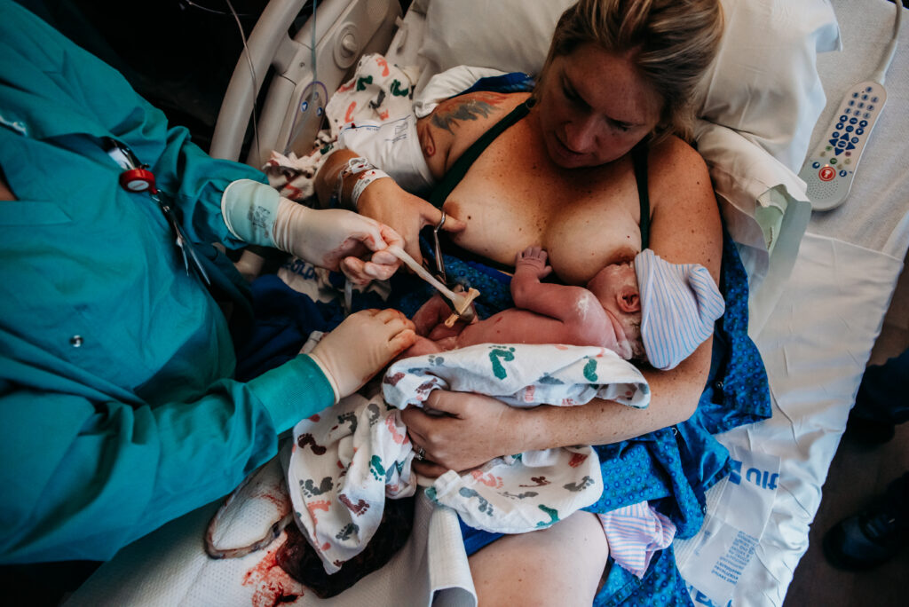 Mom cutting baby's umbilical cord while baby is on her chest at Longs Peak Hospital birth story.