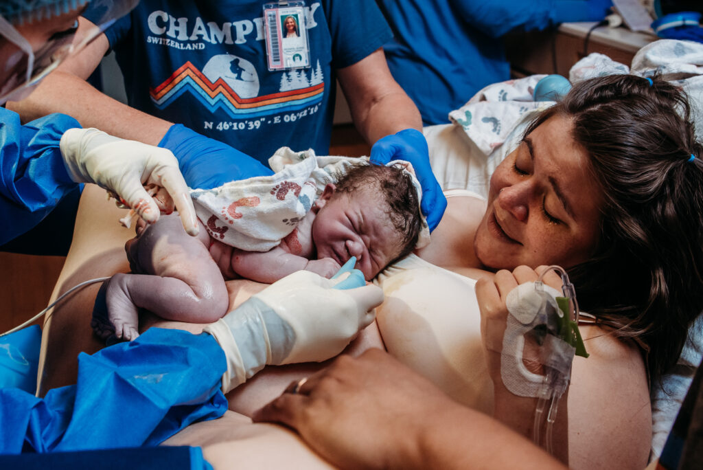 Baby being suctioned on mom's chest after birth at Children's hospital Colroado