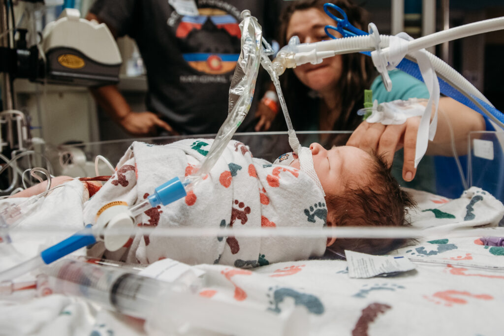 Intubated baby at Children's hospital colorado following a traumatic birth 