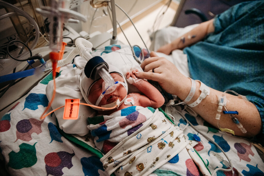 UCHealth Anschutz NICU birth stories - Mom holding hand of new baby girl in isolette.