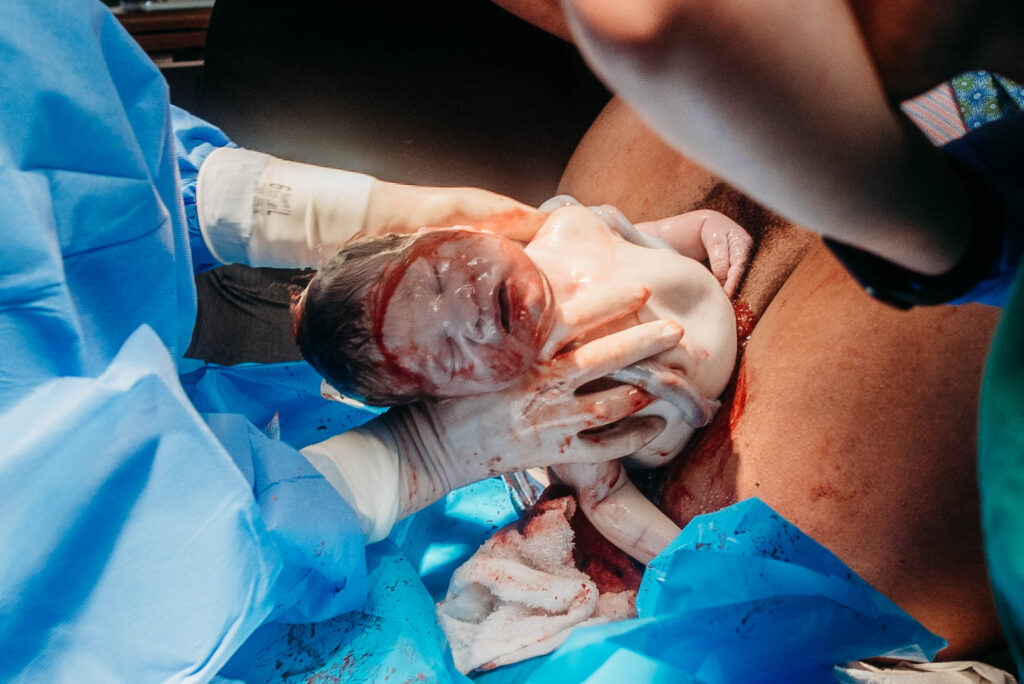 Baby emerging birth photography Longmont Colorado